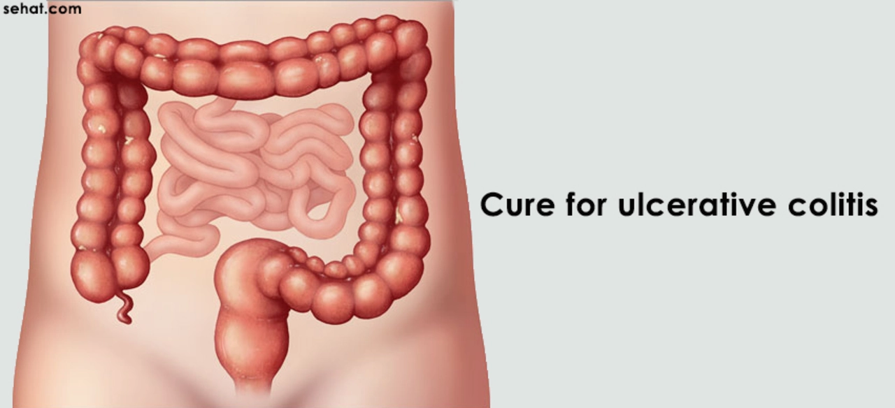 The Role of Probiotics in Ulcerative Colitis Treatment
